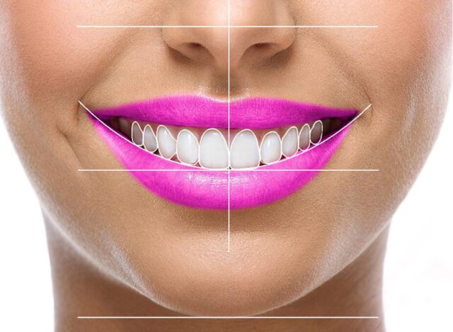 طراحی لبخند دیجیتال چیست؟
